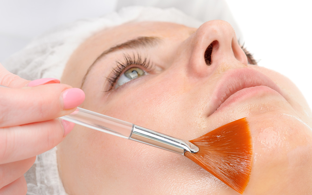 ¿Cuándo y por qué hacerse un peeling químico?