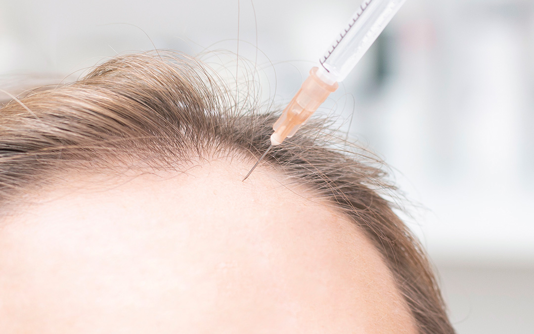 Consejos para frenar la caída del cabello