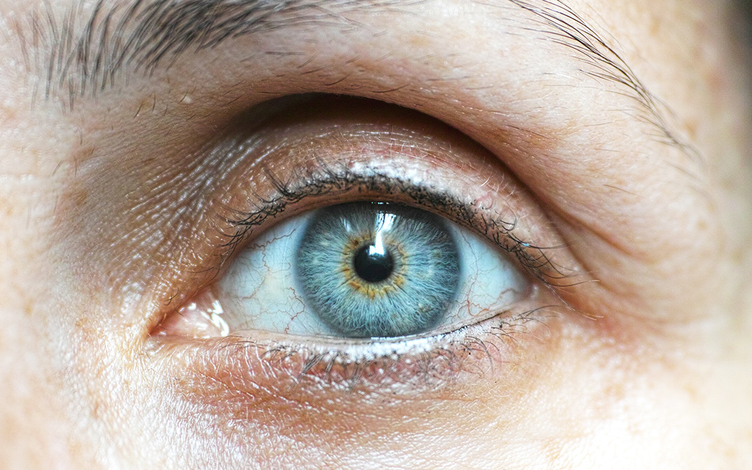 ¿Ojeras? Diles adiós en nuestra clínica médico-estética