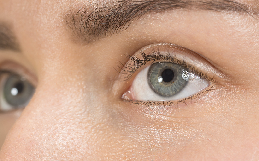 Tratamiento de carboxiterapia en las ojeras