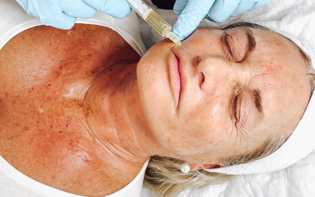8 tratamientos estrella de medicina estética para estas Navidades